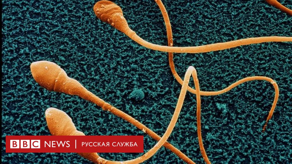 Азербайджан Потребовал Закрыть Офис Би-би-си В Баку: Подробности Инцидента Азербайджан Потребовал Закрыть Офис Би-би-си В Баку: Подробности Инцидента