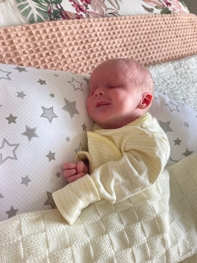 Bilateral Anophthalmia: Understanding The Rare Condition Of Being Born Without Eyes Bilateral Anophthalmia: Understanding The Rare Condition Of Being Born Without Eyes