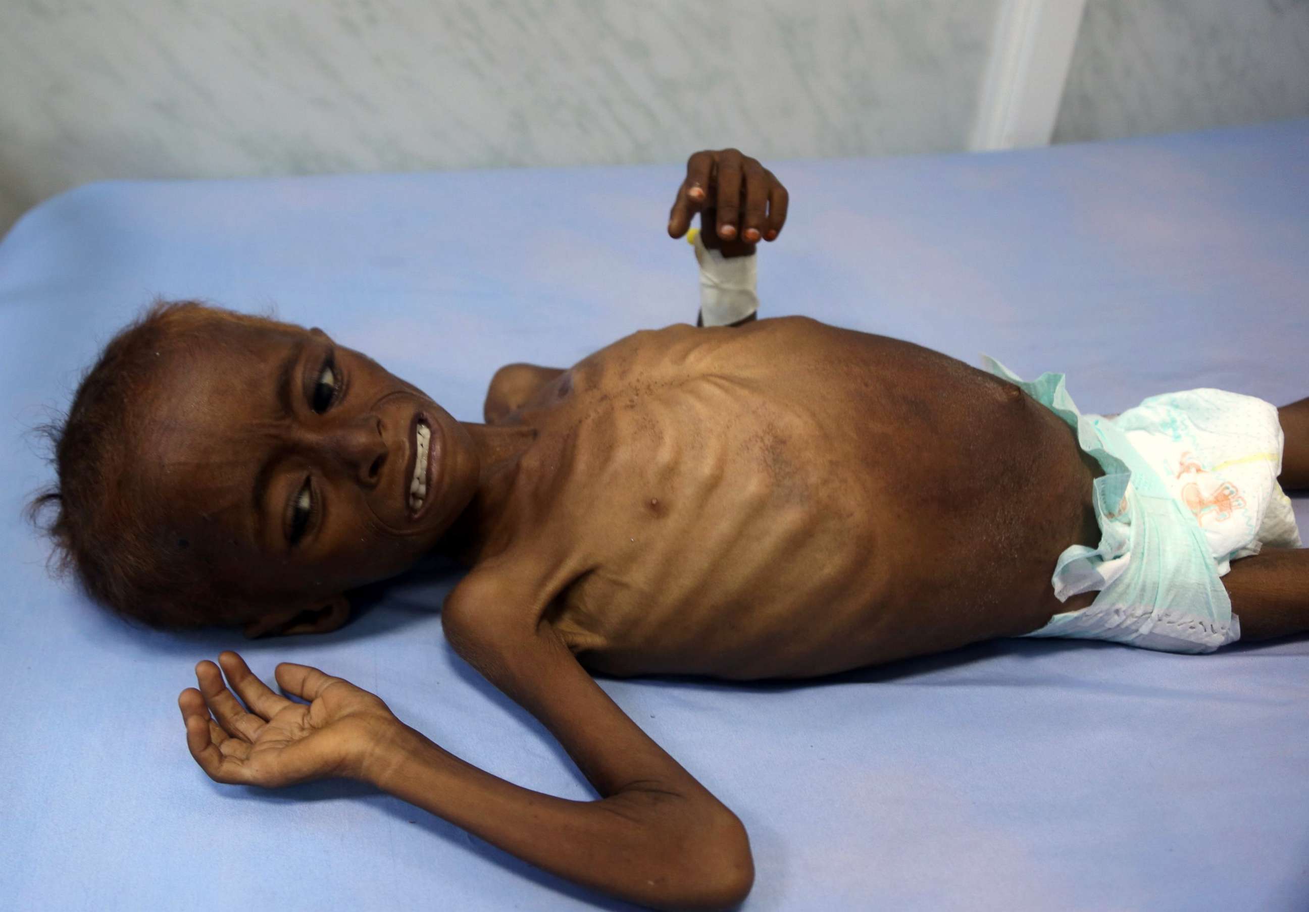 Child Drivers In Yemen's War: A Humanitarian Crisis Child Drivers In Yemen's War: A Humanitarian Crisis