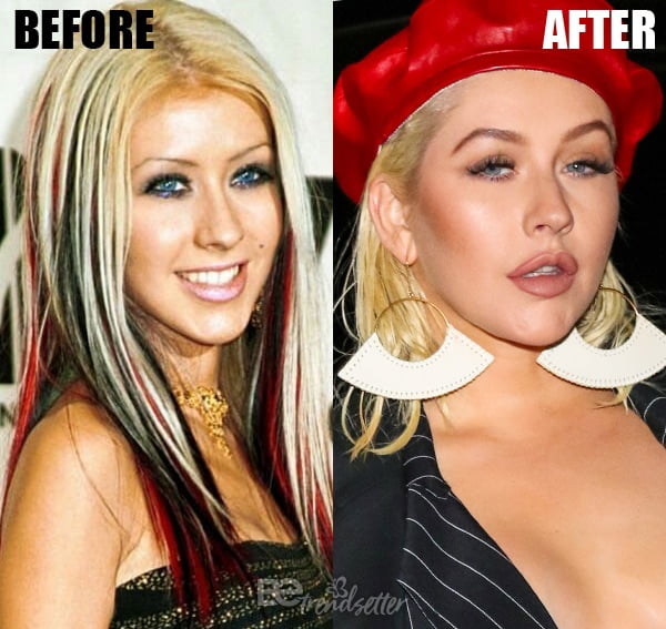 Christina Aguilera: Has She Had Plastic Surgery? Fan Reactions Explode. Christina Aguilera: Has She Had Plastic Surgery? Fan Reactions Explode.