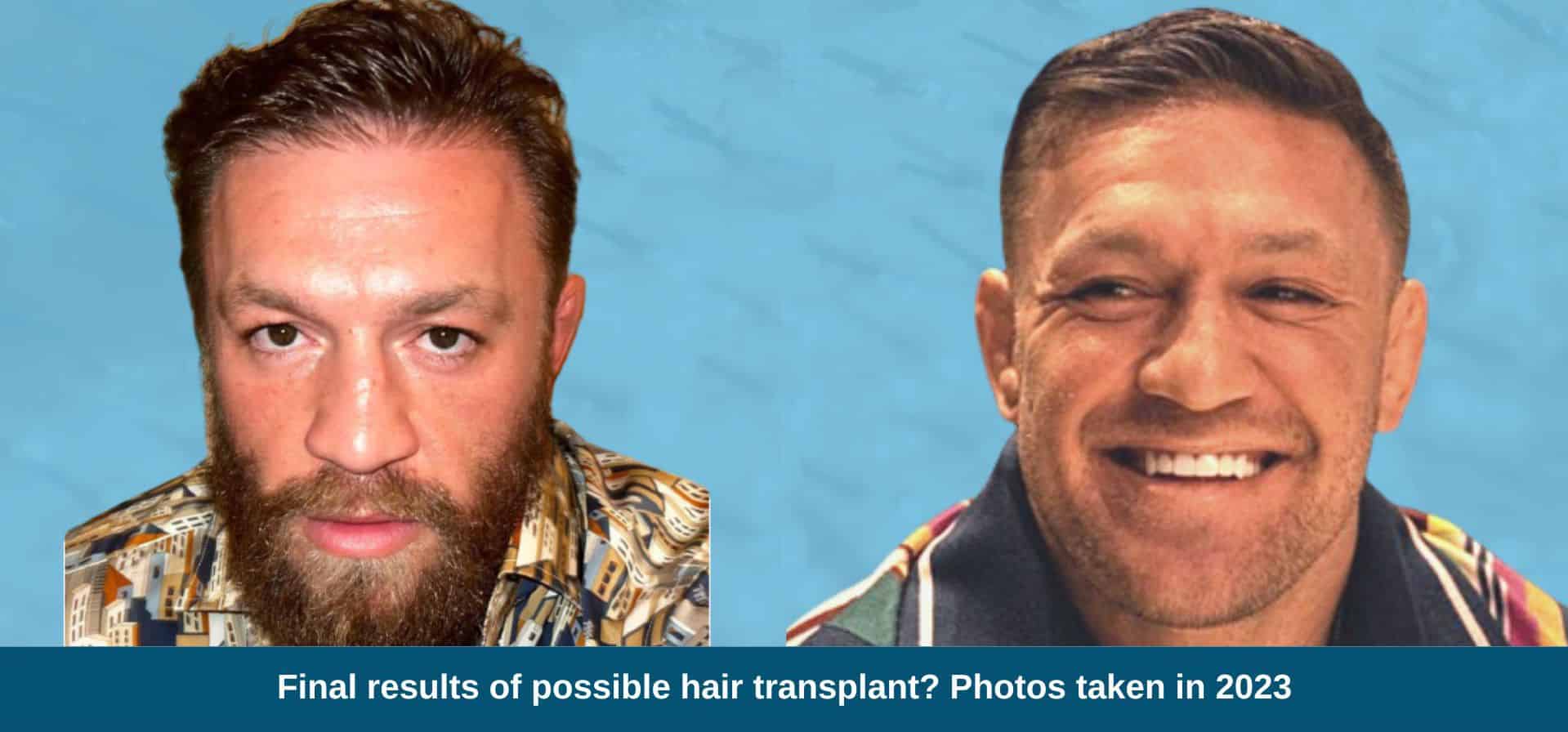 Conor McGregor's Recent Fox News Appearances: A Comprehensive Overview Conor McGregor's Recent Fox News Appearances: A Comprehensive Overview