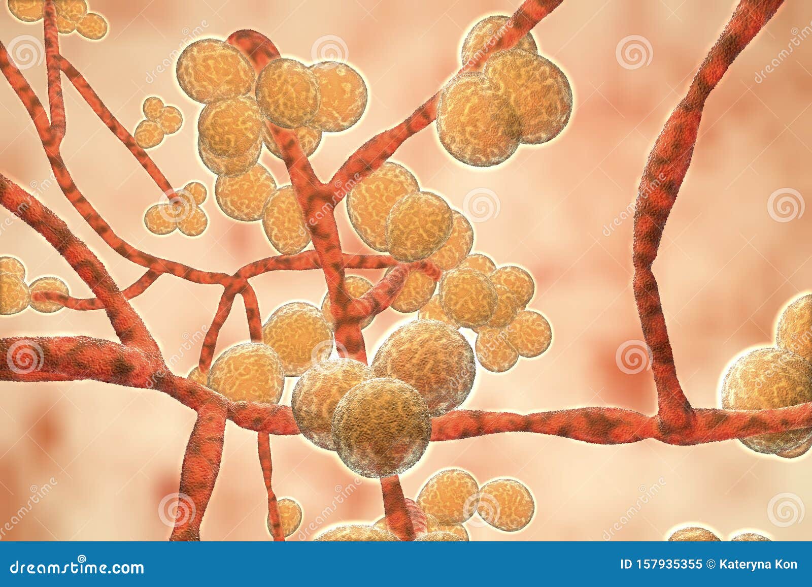 Deadly Fungi: The Emerging Superbug Crisis Deadly Fungi: The Emerging Superbug Crisis