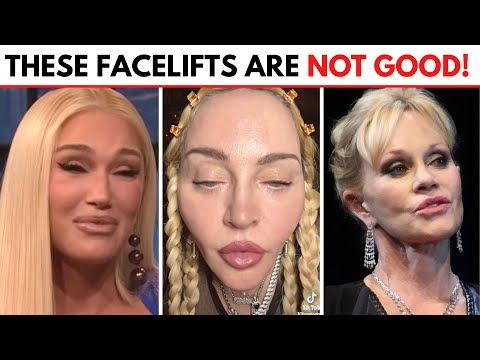 Facelift Fail? Public Reaction To Celebrity's New Photoshoot Is Harsh Facelift Fail? Public Reaction To Celebrity's New Photoshoot Is Harsh