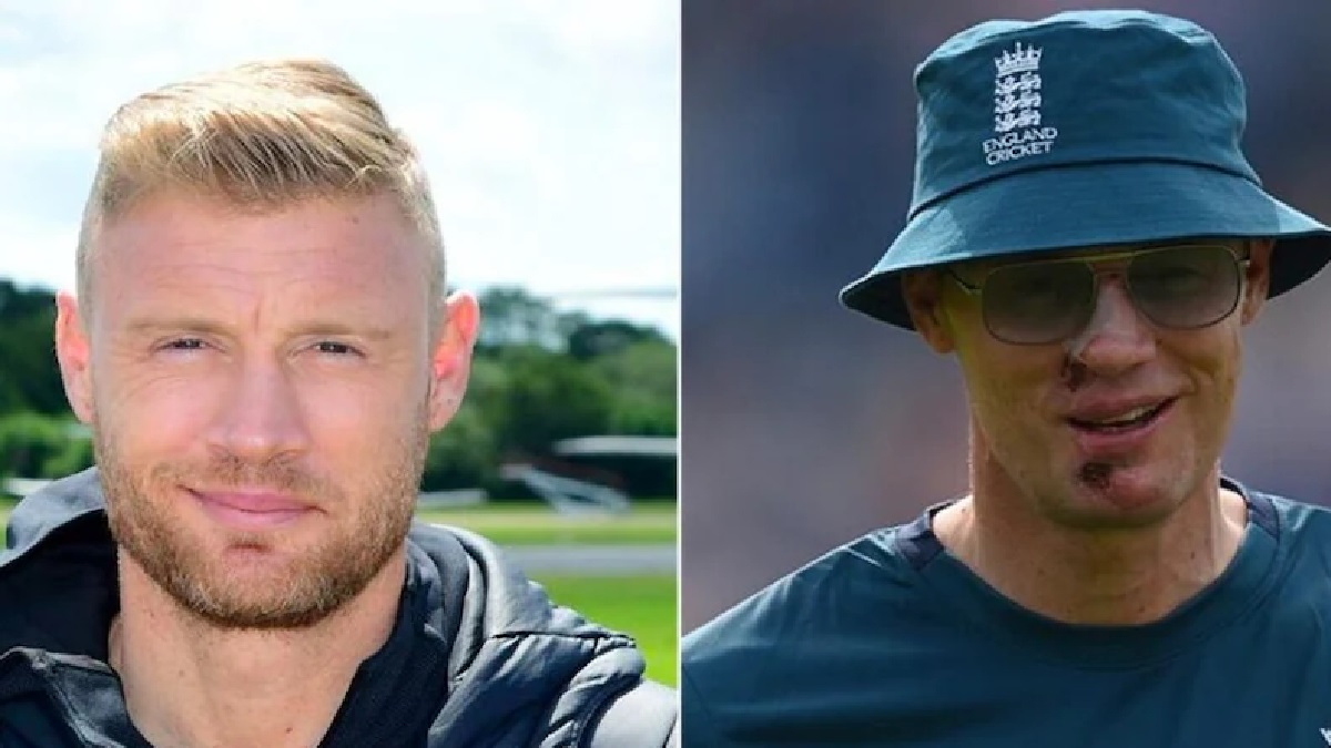 Freddie Flintoff's Healed Face: Post-Top Gear Crash Update Freddie Flintoff's Healed Face: Post-Top Gear Crash Update