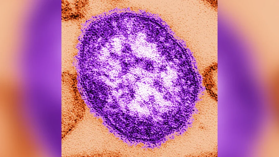 Increase In Texas Measles Cases: Multiple, Unconnected Outbreaks Increase In Texas Measles Cases: Multiple, Unconnected Outbreaks