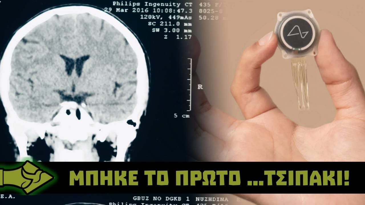 ΗΠΑ: Η Κριτική Του Μασκ Στο ΗΠΑ: Η Κριτική Του Μασκ Στο