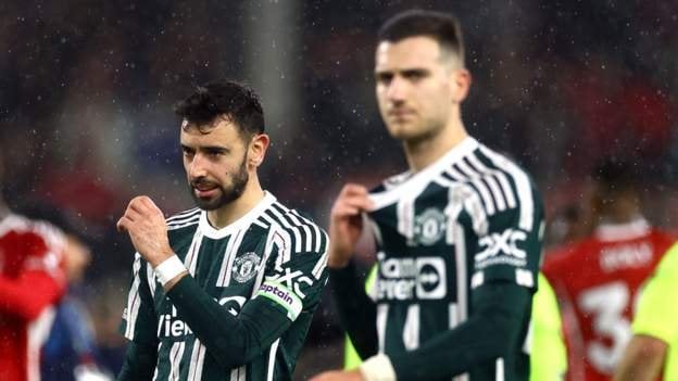 Man Utd Player Receives Backlash After Costly Mistake And Elephantine Touch Celebration Man Utd Player Receives Backlash After Costly Mistake And Elephantine Touch Celebration