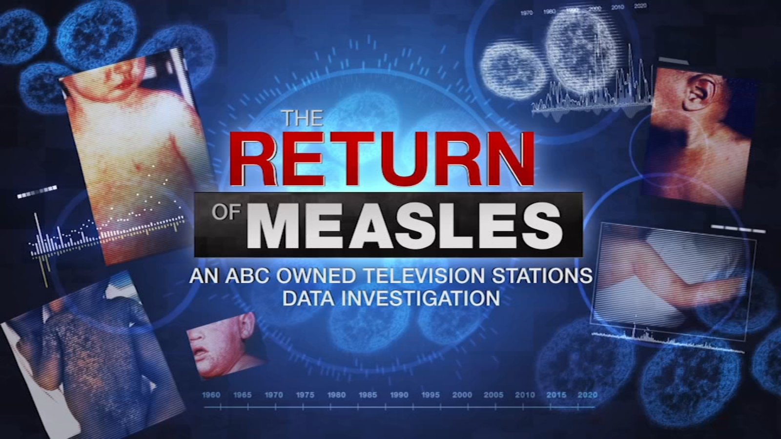 Measles Surge Prompts Increased US Vaccine Oversight Measles Surge Prompts Increased US Vaccine Oversight