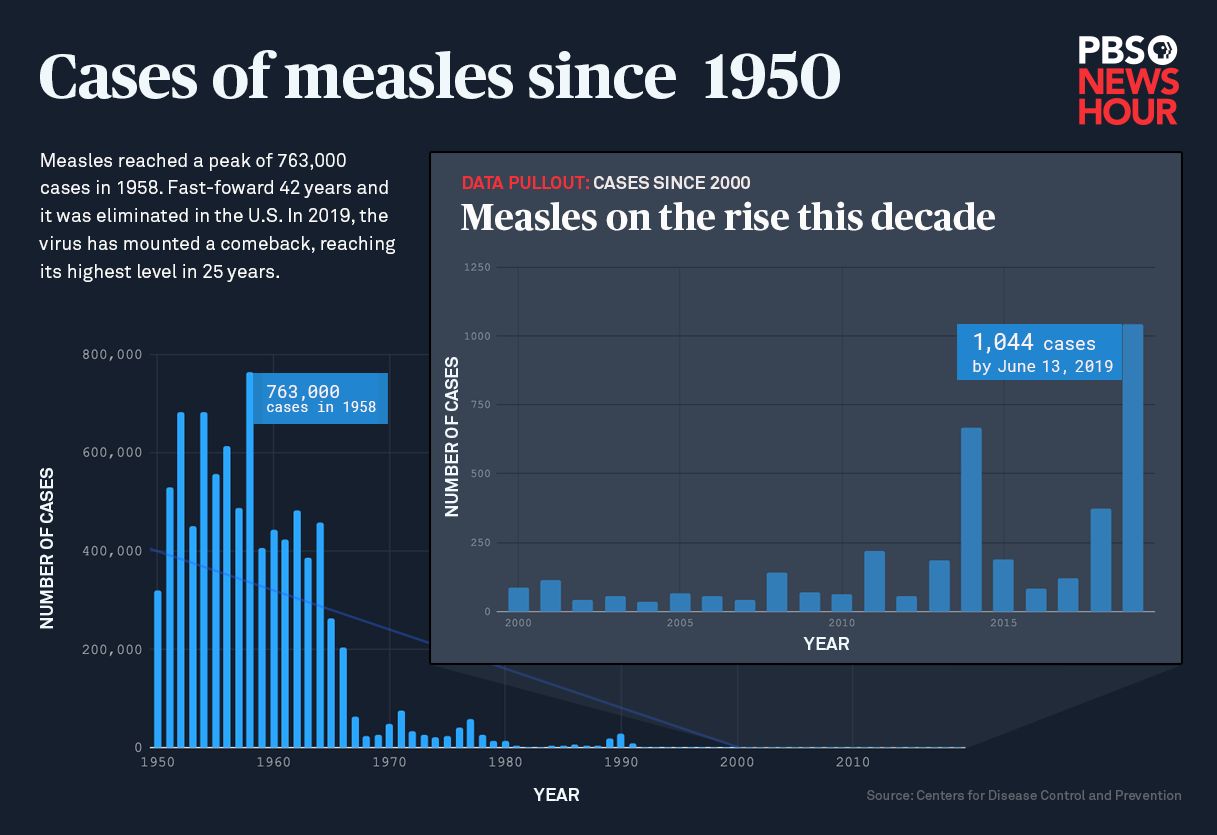 Recent Measles Outbreak In The United States: Key Updates And Data Recent Measles Outbreak In The United States: Key Updates And Data