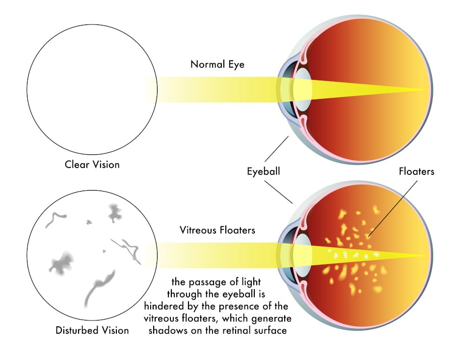 Red Light Flashes In French Skies: A Closer Look At The Phenomenon Red Light Flashes In French Skies: A Closer Look At The Phenomenon
