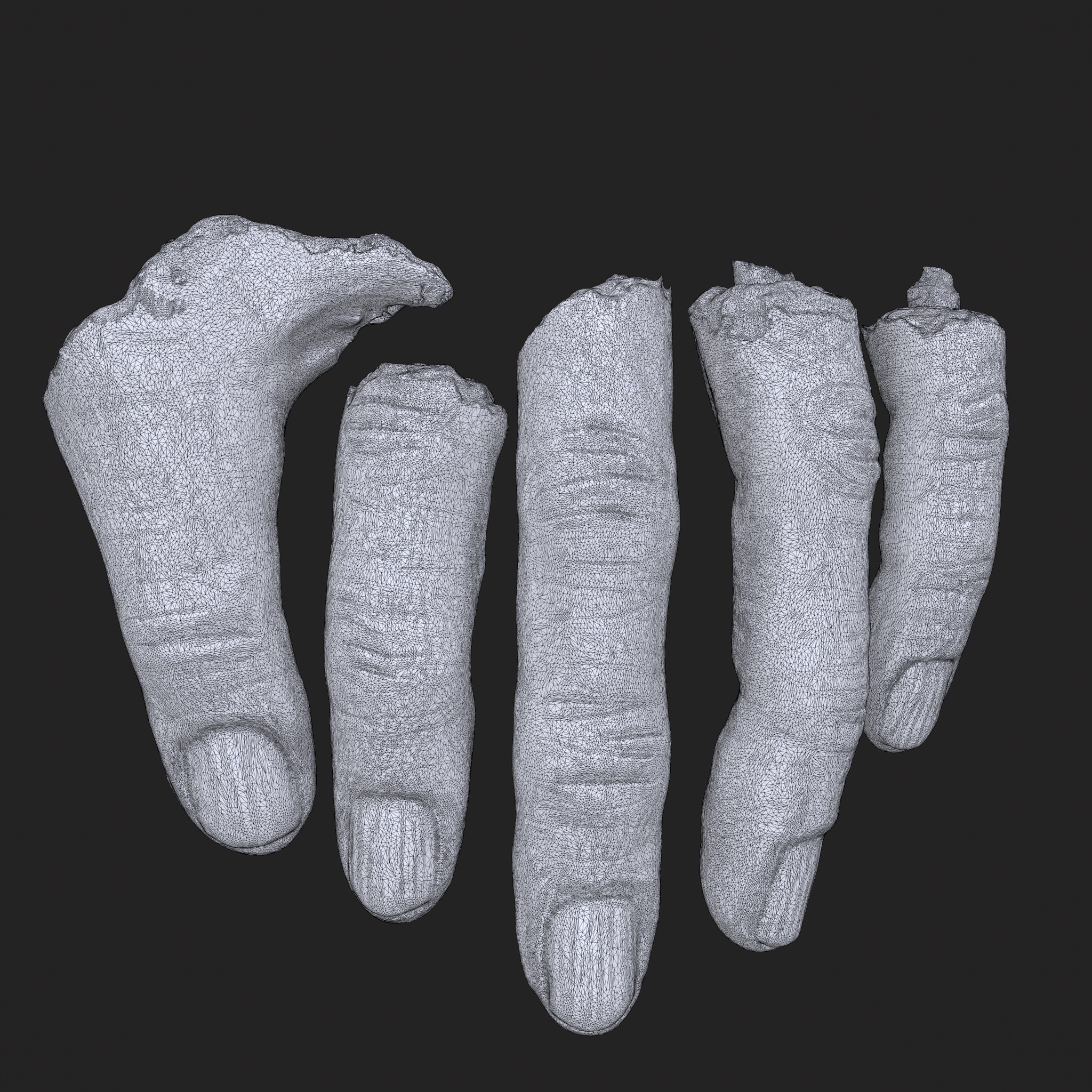 The Dark Side Of Crypto Wealth: Severed Fingers And Violent Attacks The Dark Side Of Crypto Wealth: Severed Fingers And Violent Attacks