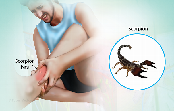 Three Scorpion Stings: The Will Trent Star's Unbelievable Night Three Scorpion Stings: The Will Trent Star's Unbelievable Night