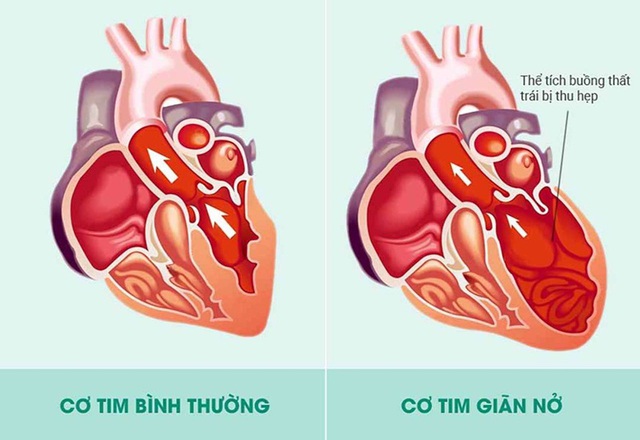 Tìm Hiểu Thời Gian Xông Hơi Phù Hợp Với Sức Khỏe Của Bạn Tìm Hiểu Thời Gian Xông Hơi Phù Hợp Với Sức Khỏe Của Bạn