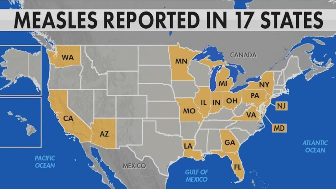 Tracking The Measles Outbreak: Where Cases Are Rising In The United States Tracking The Measles Outbreak: Where Cases Are Rising In The United States