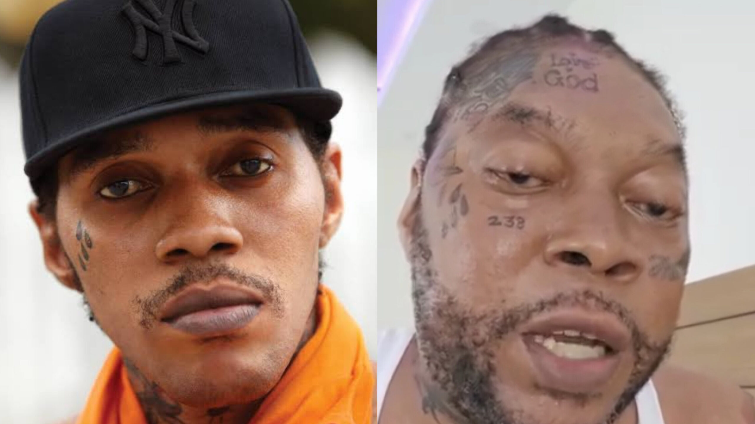 Vybz Kartel Opens Up: Skin Bleaching And The Battle For Self-Acceptance Vybz Kartel Opens Up: Skin Bleaching And The Battle For Self-Acceptance